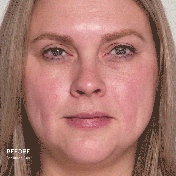 HydroPure™ Color Correcting Serum with Hyaluronic Acid & CoQ10
