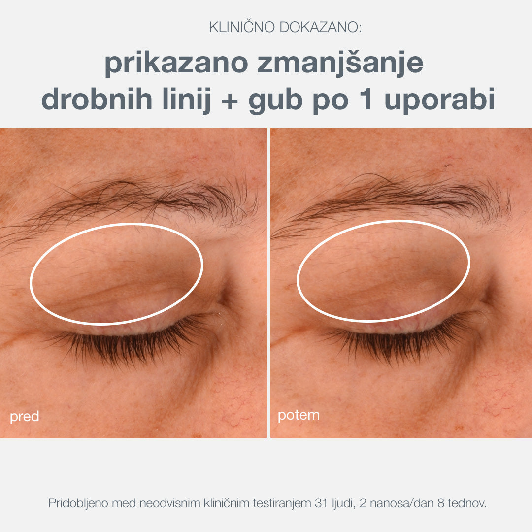 phyto nature lifting eye cream