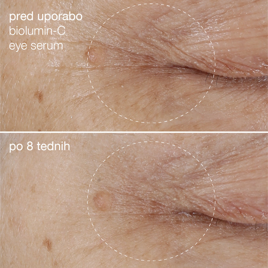 biolumin-c eye serum