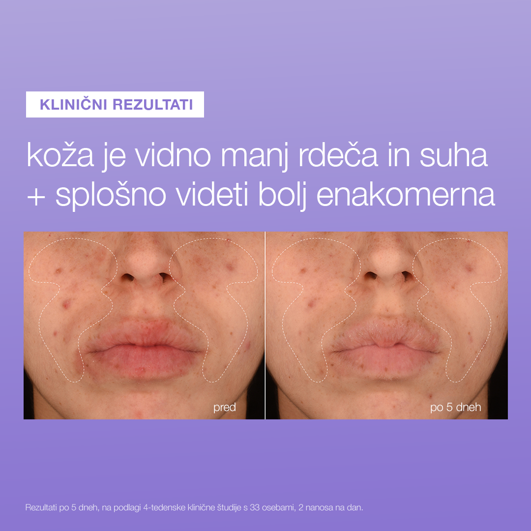 stabilizing repair serum