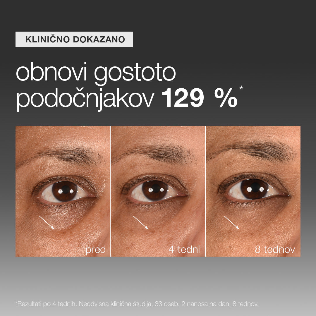 smart eye density
