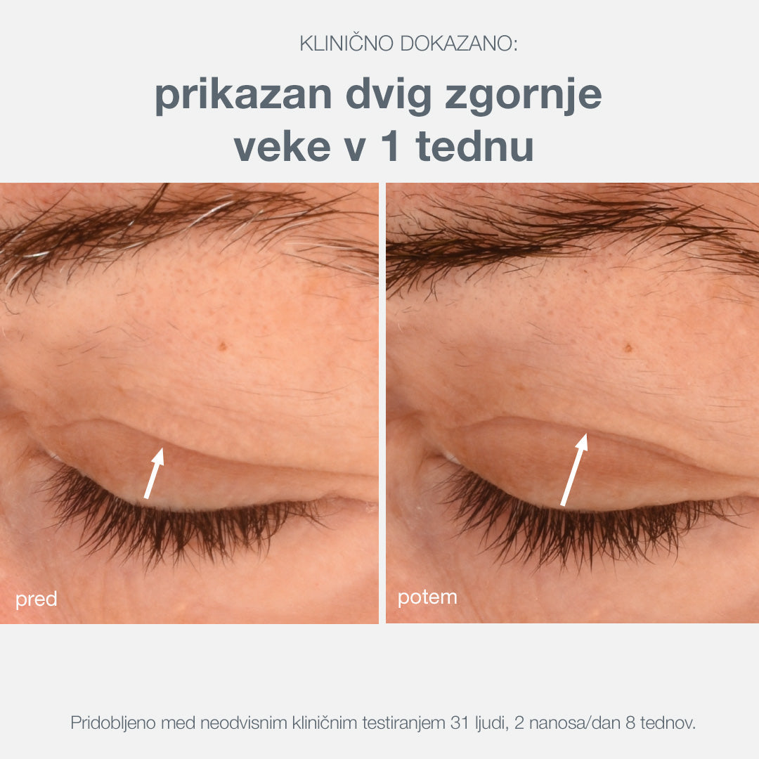 phyto nature lifting eye cream