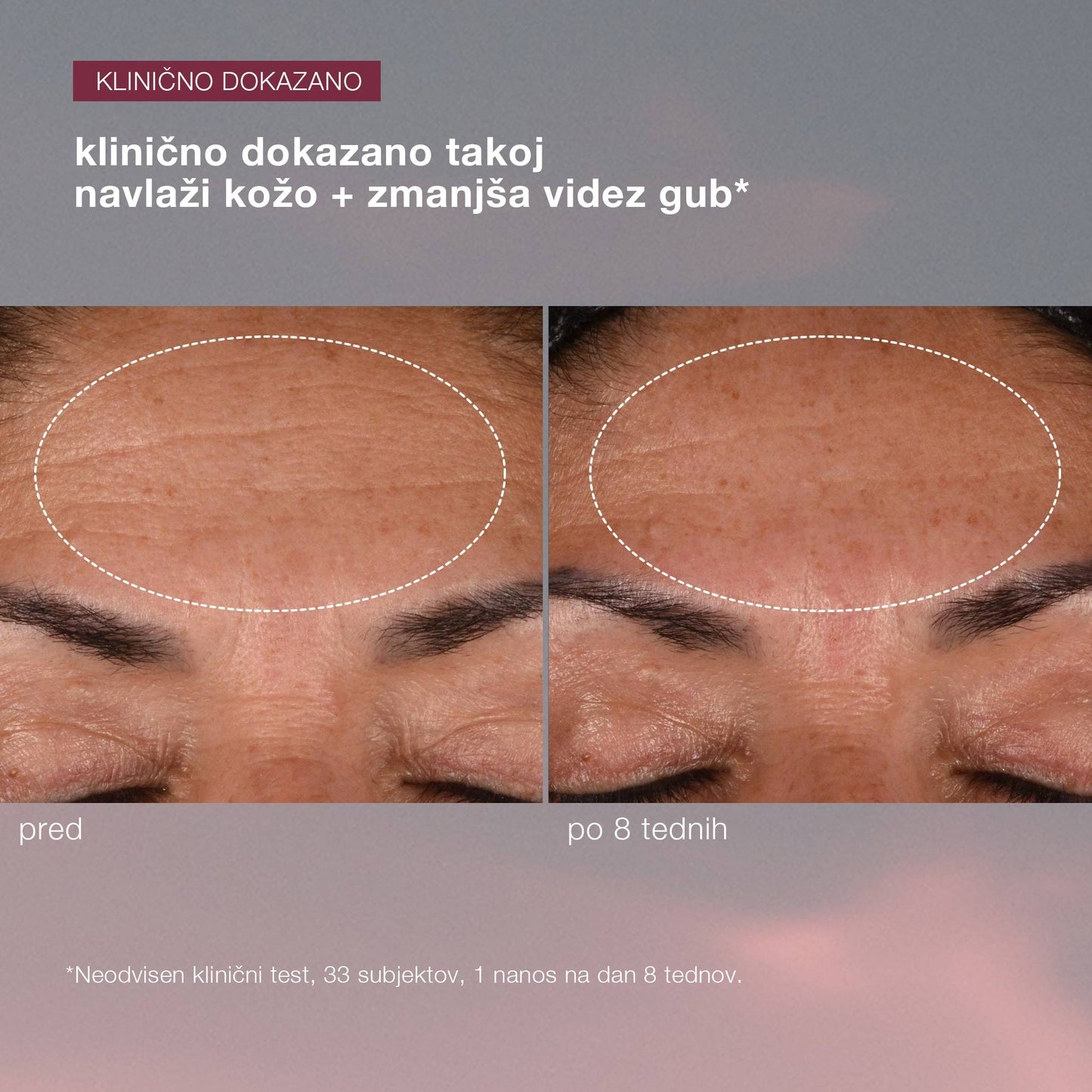 dynamic skin recovery spf50
