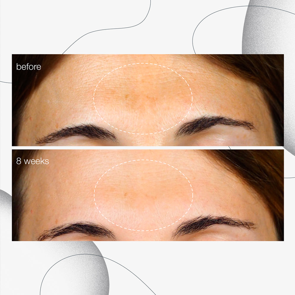 powerbright dark spot serum